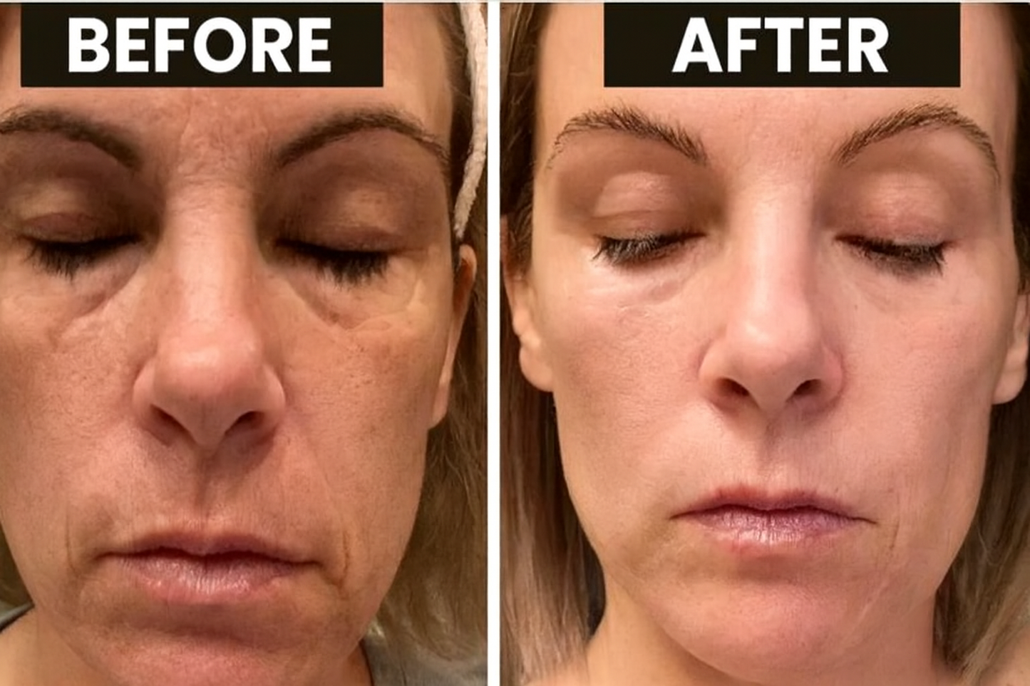 Level 27 LED Photon Mask